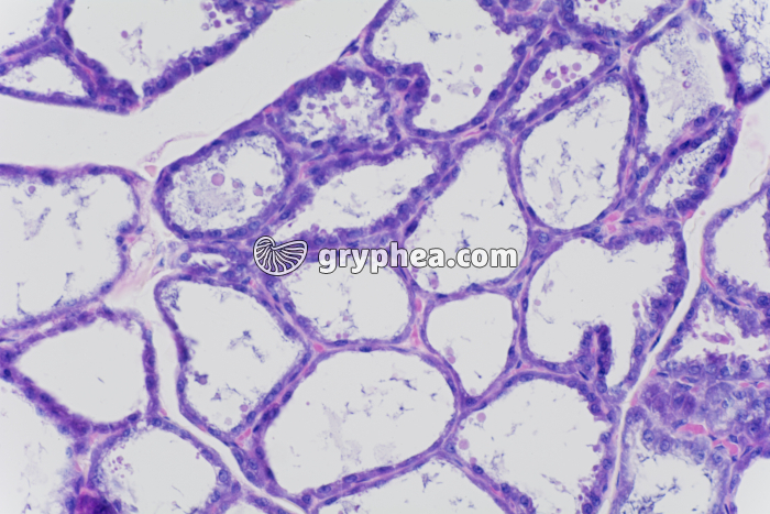 Glande mammaire en activité x100 - gryphea.com